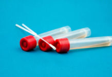 Coronavirus, 147 nuovi casi e 4 decessi negli ultimi sette giorni