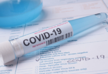 COVID IN TOSCANA, 211 nuovi casi. Slitta la vaccinazione