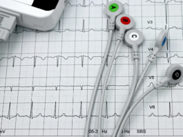 OSPEDALE, CARDIOLOGIA ALLO STREMO. “A rimetterci è sempre e solo Pescia”