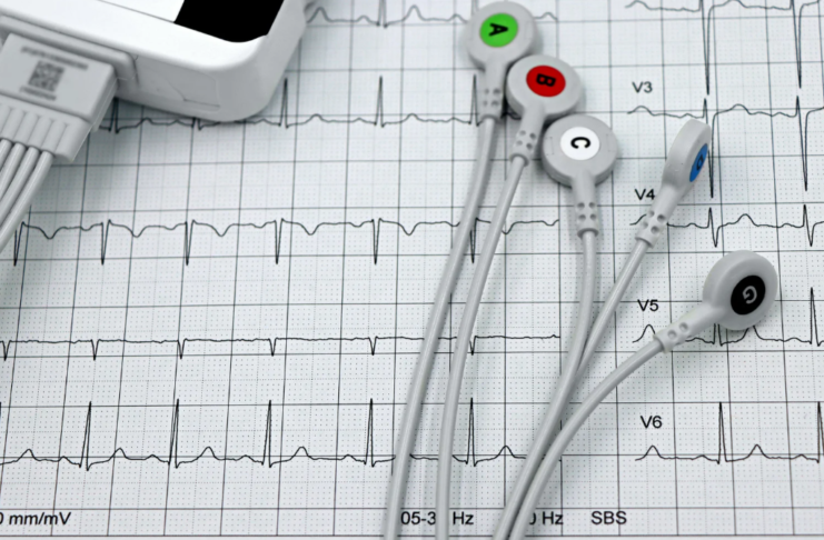 OSPEDALE, CARDIOLOGIA ALLO STREMO. “A rimetterci è sempre e solo Pescia”